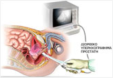 Υπερηχογράφημα Προστάτη