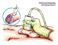 Υπερηχογράφημα Αγγείων Πέους