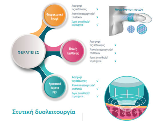 Στυτική δυσλειτουργία