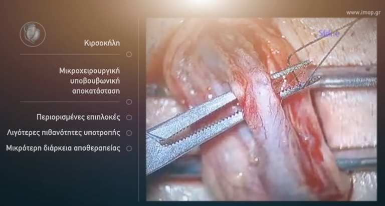 13. Μικροσκοπική επέμβαση